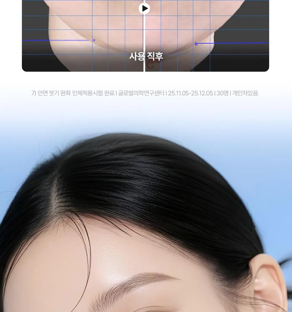 [쿨링/진정] 센텔리안24 마데카 수분크림 하이드라 카밍 기획(50ml+15ml) 상세페이지 27